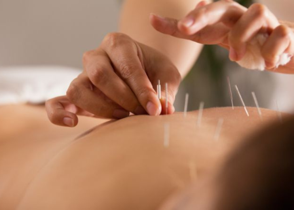 Châm cứu trị mất ngủ, thực tế hay chỉ là suy đoán? 